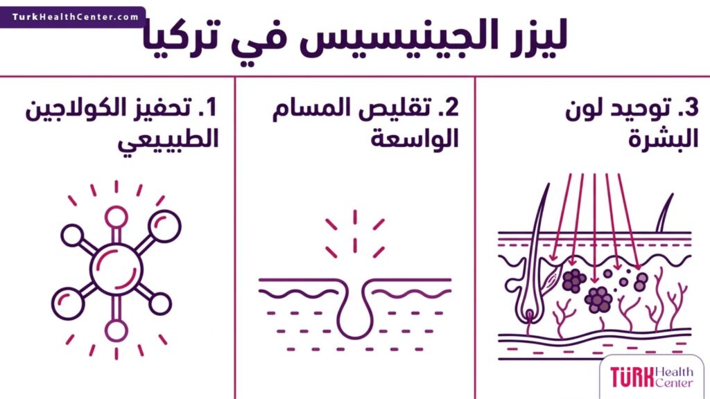 إنفوجرافيك طبي يستعرض أهم ثلاث فوائد طبية لإجراء ليزر الجينيسيس في تركيا.