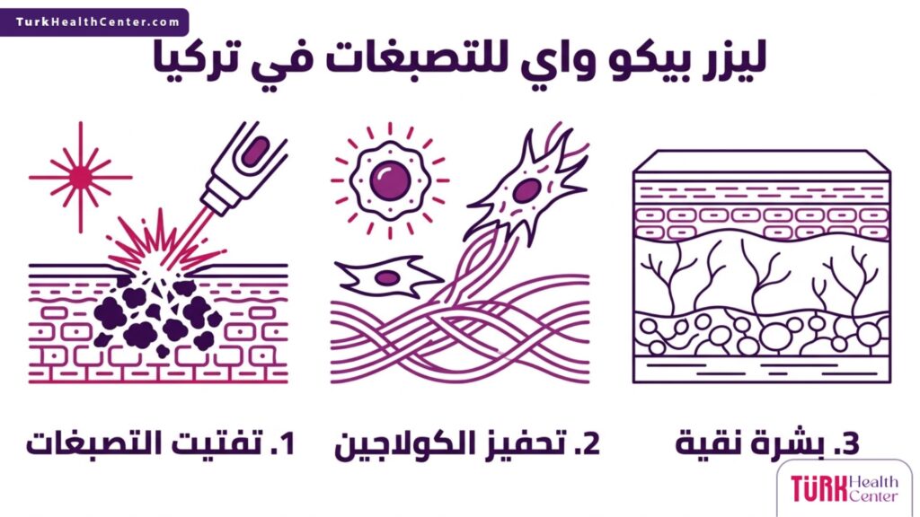 تصميم إنفوجرافيك طبي يوضح مراحل العلاج والفوائد المباشرة لاستخدام ليزر بيكو واي للتصبغات في تركيا.