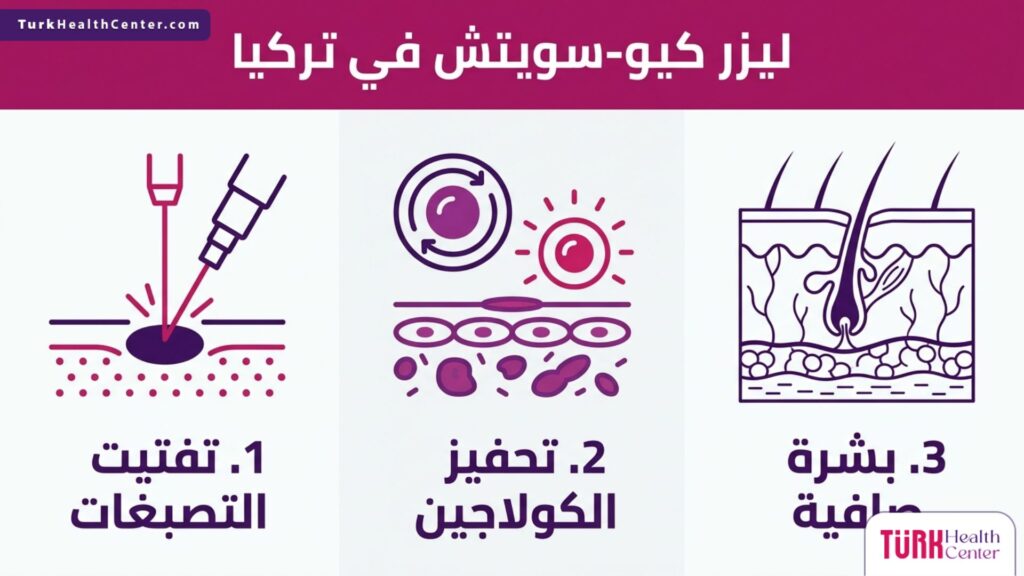 إنفوجرافيك يوضح فوائد ومراحل العلاج باستخدام ليزر كيو-سويتش في تركيا.