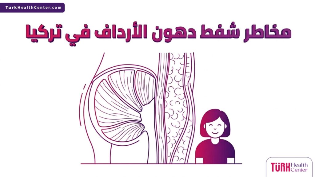 إنفوجرافيك تشريحي دقيق يوضح طبقات الدهون وكيفية تفادي مخاطر شفط دهون الأرداف في تركيا بطريقة آمنة.