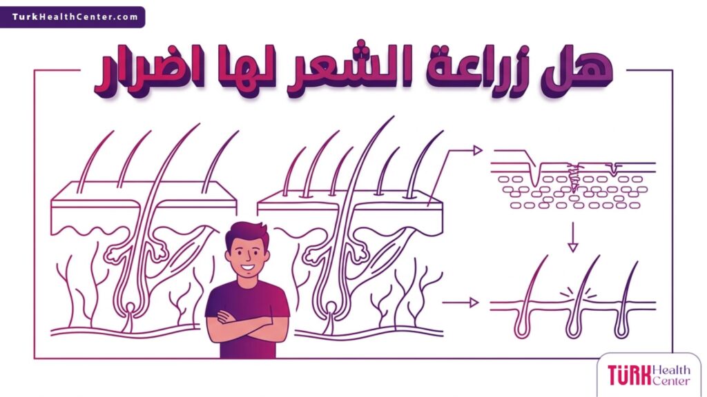 إنفوجرافيك طبي دقيق يوضح التشريح الداخلي لفروة الرأس والبصيلات للإجابة علمياً على سؤال هل زراعة الشعر لها اضرار.