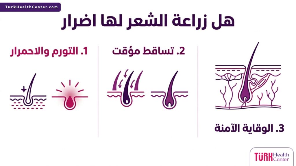 تصميم إنفوجرافيك يستعرض أهم الأعراض الجانبية المرافقة لسؤال هل زراعة الشعر لها اضرار مثل التورم والتساقط المؤقت.