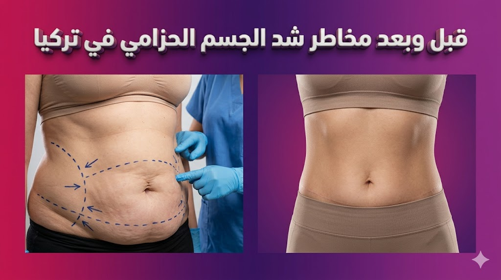 مقارنة قبل وبعد توضح نتائج العملية مع تسليط الضوء على مخاطر شد الجسم الحزامي في تركيا لرفع الوعي الطبي.