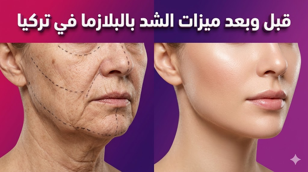 مقارنة واقعية قبل وبعد تظهر ميزات الشد بالبلازما في تركيا على بشرة الوجه مع نص عربي ثلاثي الأبعاد.