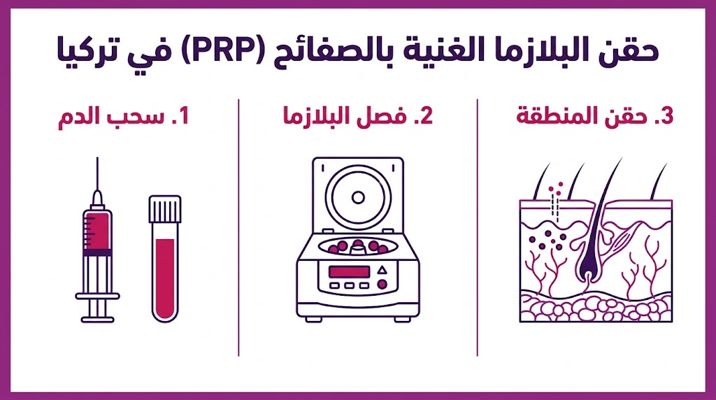  إنفوجرافيك يوضح مراحل عملية حقن البلازما الغنية بالصفائح (PRP) في تركيا بالتفصيل.