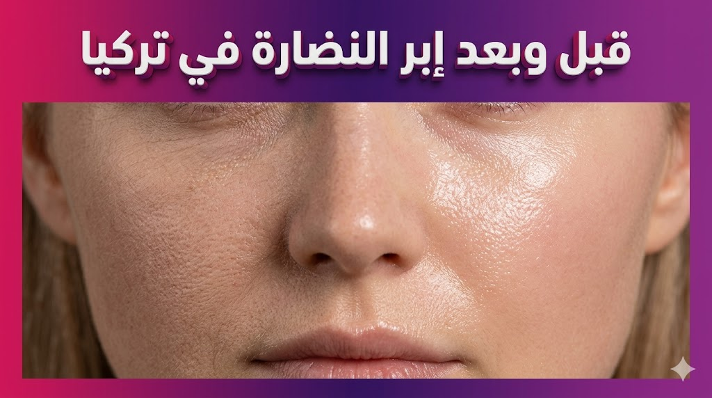 مقارنة قبل وبعد توضح نتائج إبر النضارة في تركيا على حيوية وإشراق بشرة الوجه.