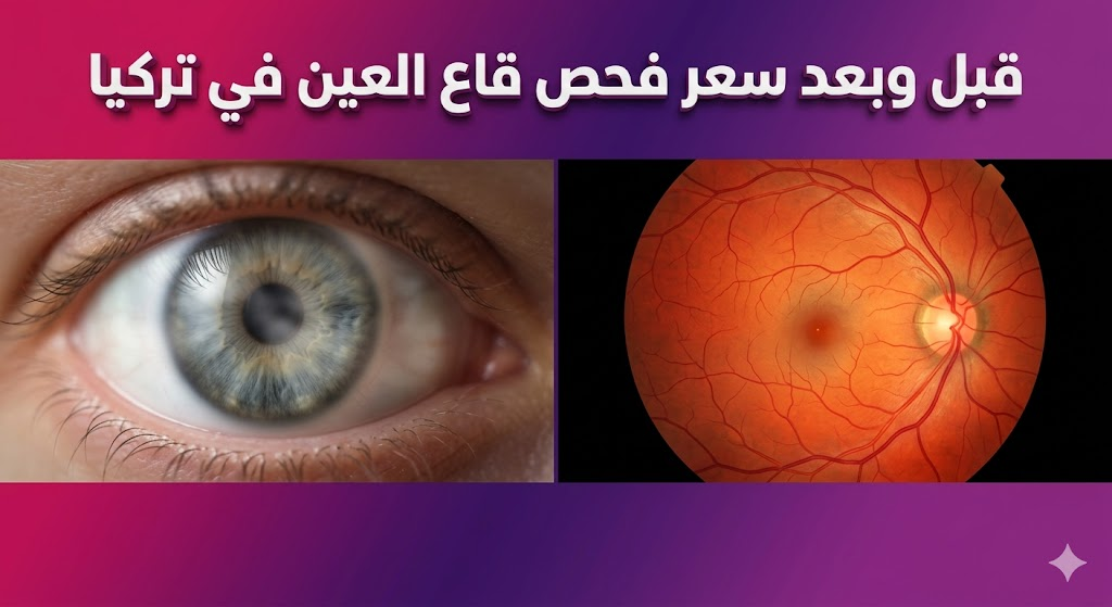  مقارنة قبل وبعد توضح دقة التشخيص بعد معرفة سعر فحص قاع العين في تركيا والحصول على الخدمة.