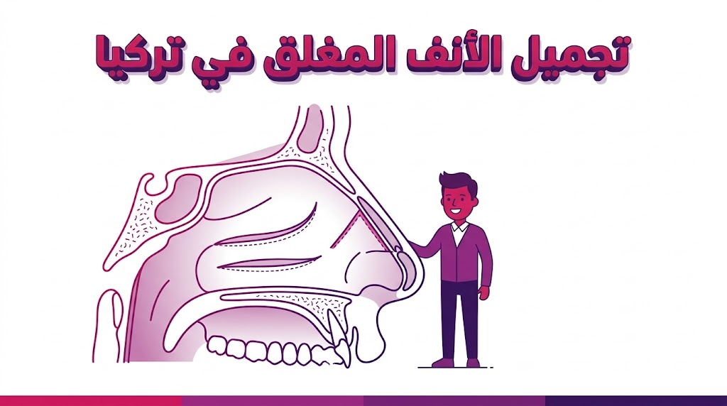  مخطط تشريحي تعليمي يوضح آلية العمل الداخلية والتقنيات المستخدمة في تجميل الأنف المغلق في تركيا.