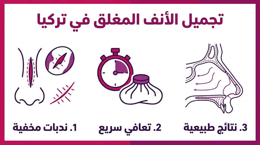إنفوجرافيك طبي يشرح مميزات تجميل الأنف المغلق في تركيا من حيث الندبات، فترة النقاهة، وطبيعية النتائج.
