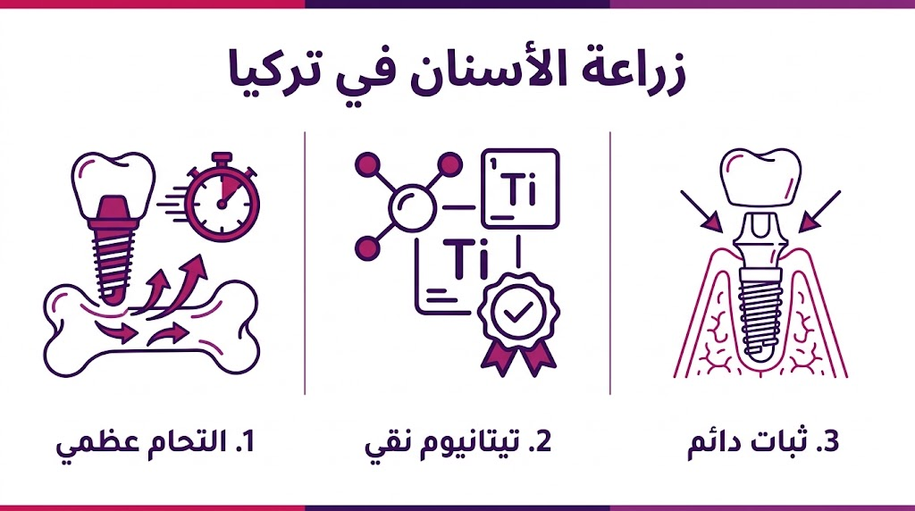 بوستر إنفوجرافيك يوضح ثلاث مراحل أساسية في زراعة الأسنان في تركيا تشمل التحام العظم وجودة التيتانيوم.