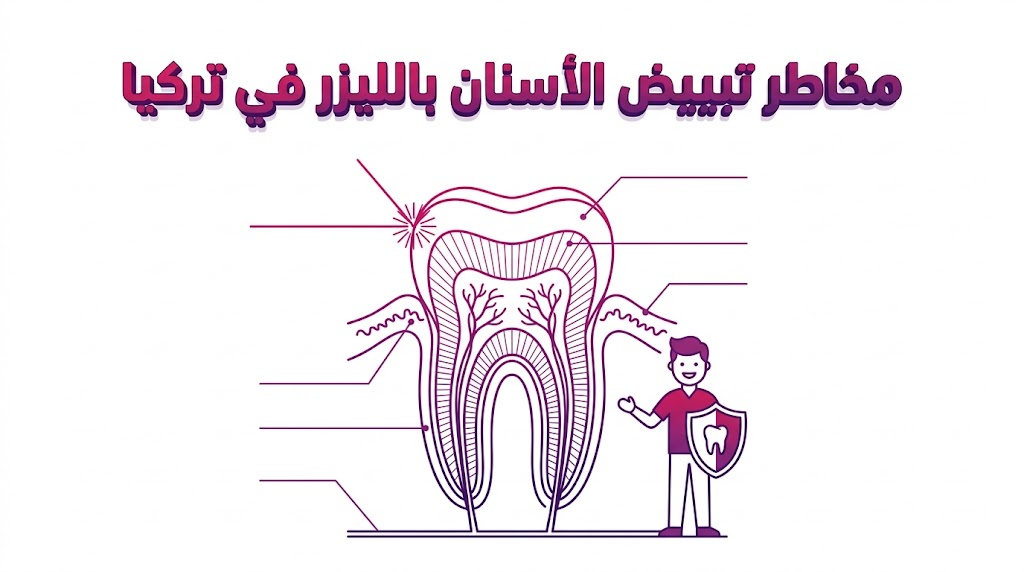 مخطط تشريحي يوضح بنية السن والاعتبارات الطبية لتفادي مخاطر تبييض الأسنان بالليزر في تركيا بشكل علمي.