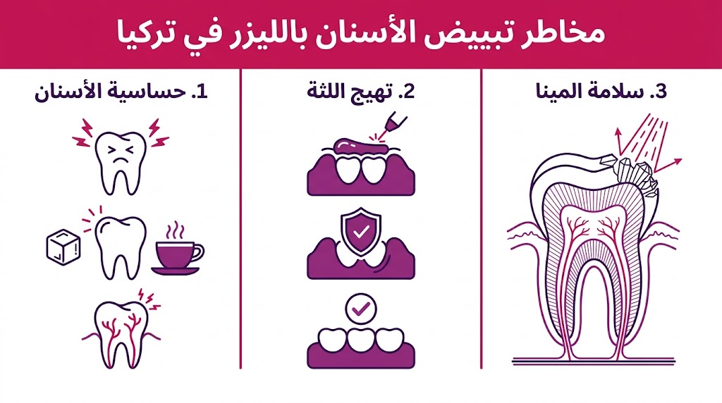 إنفوجرافيك طبي يوضح أهم 3 نقاط يجب الحذر منها بخصوص مخاطر تبييض الأسنان بالليزر في تركيا لضمان سلامة الفم.