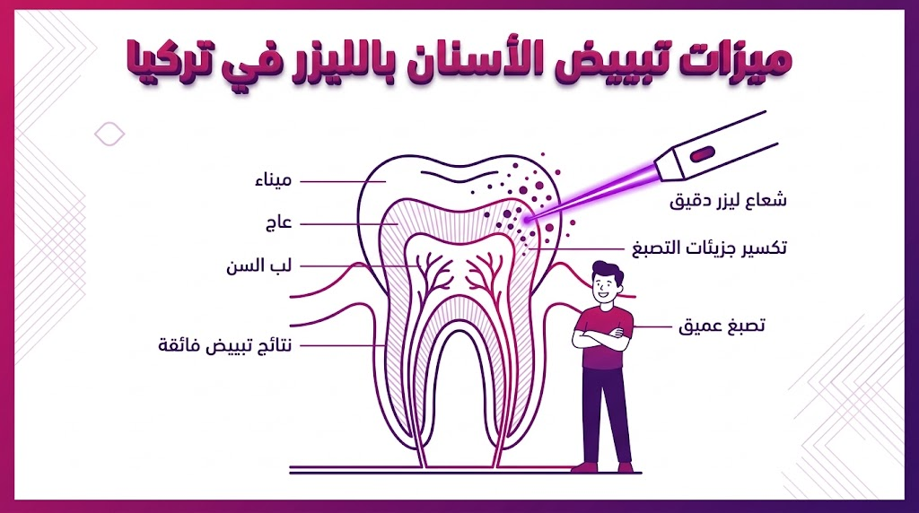 إنفوجرافيك تعليمي يوضح الآلية العلمية لميزات تبييض الأسنان بالليزر في تركيا وكيفية اختراق الليزر لطبقات السن.
