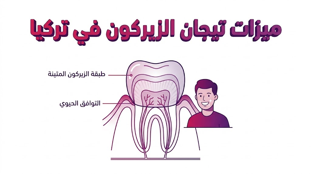 مخطط تشريحي متجه (Vector) يوضح التركيب الداخلي والدقة العلمية لتثبيت تيجان الزيركون في تركيا على السن.