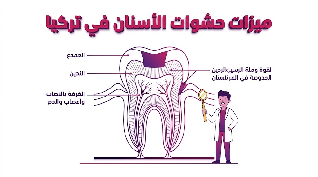 مخطط طبي توضيحي يشرح ميزات حشوات الأسنان في تركيا والتركيب التشريحي للحشوة داخل السن.