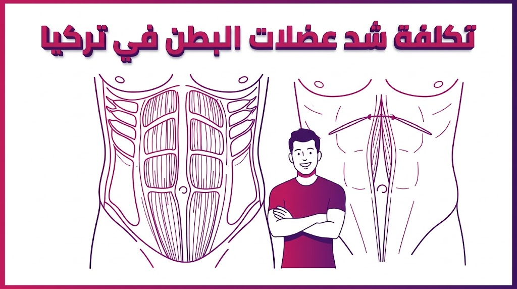 إنفوجرافيك طبي يوضح التشريح الداخلي وعملية تقوية العضلات ضمن تكلفة شد عضلات البطن في تركيا.