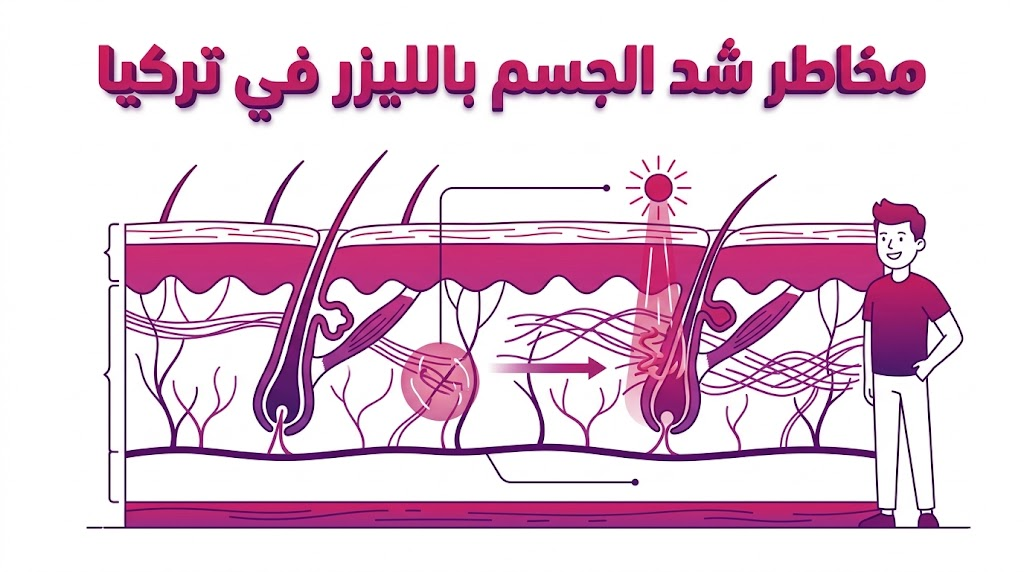 مخطط تشريحي طبي يوضح تفاعل طبقات الجلد مع أشعة الليزر لتجنب مخاطر شد الجسم بالليزر في تركيا.