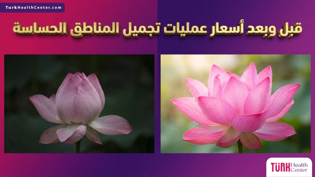 صورة مجازية قبل وبعد تظهر زهرة لوتس تمثل التجديد والجمال الأنثوي المرتبط بـ أسعار عمليات تجميل المناطق الحساسة.