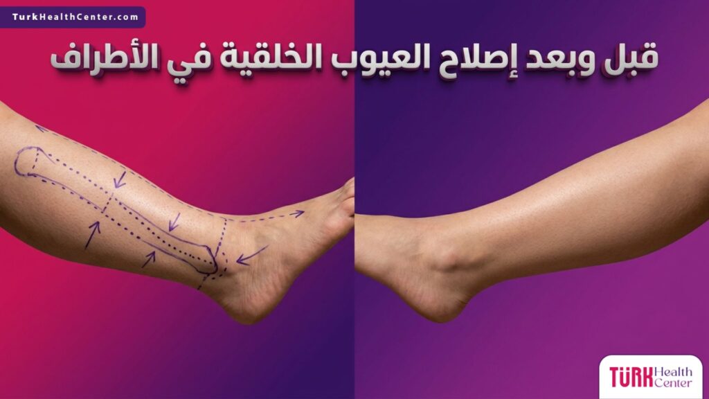 مقارنة تفصيلية قبل وبعد عملية إصلاح العيوب الخلقية في الأطراف لاستعادة التناسق التشريحي.