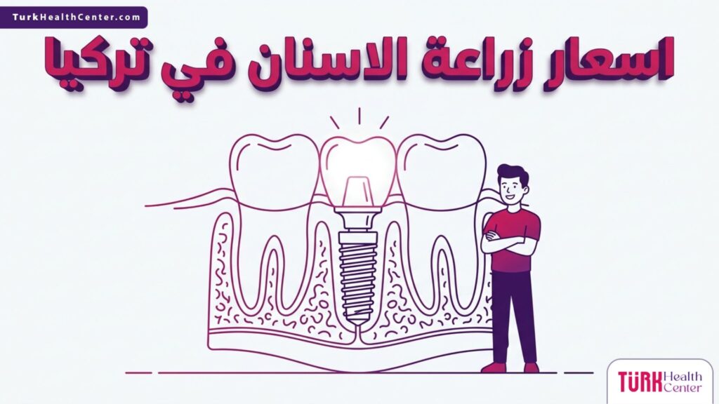 إنفوجرافيك طبي يوضح التركيب التشريحي للغرسة داخل الفك وعلاقتها مع اسعار زراعة الاسنان في تركيا.