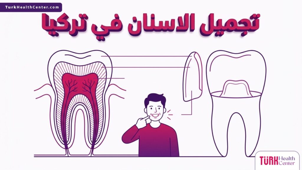 إنفوجرافيك تشريحي دقيق يشرح تركيبة السن وخطوات تركيب القشور التجميلية ضمن إجراءات تجميل الاسنان في تركيا