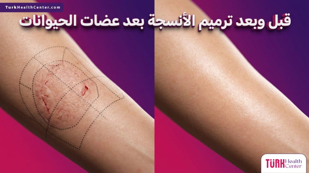 صورة مقسمة قبل وبعد تظهر التحول الطبي المذهل في ترميم الأنسجة بعد عضات الحيوانات مع علامات الجراحة الطبية.