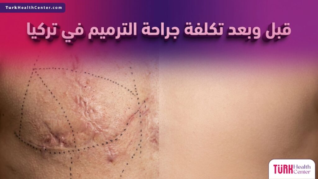 صورة احترافية تقارن بين حالة الجلد قبل وبعد العلاج لتوضيح نتائج وتبرير تكلفة جراحة الترميم في تركيا بوضوح.