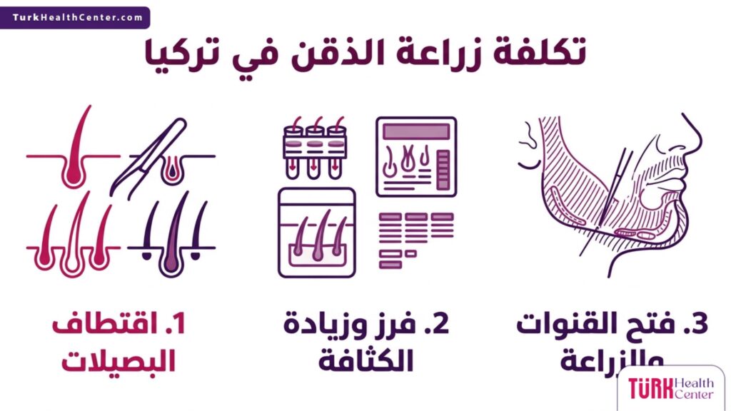 بوستر إنفوجرافيك تعليمي مقسم لثلاثة أعمدة يوضح العوامل التقنية المؤثرة في تكلفة زراعة الذقن في تركيا