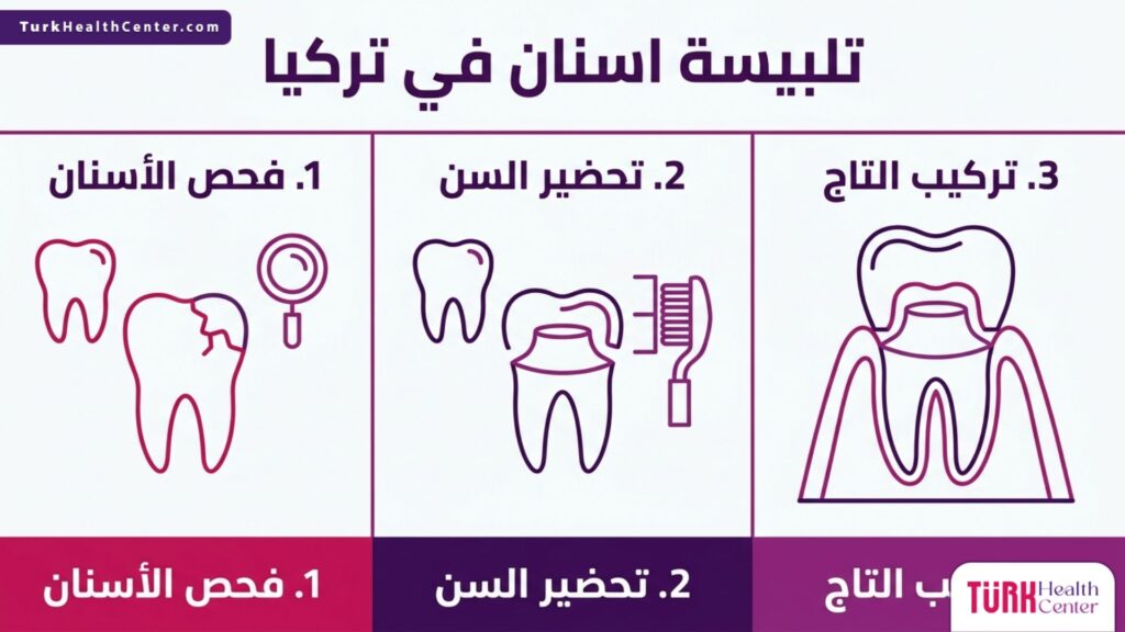 تصميم إنفوجرافيك يوضح خطوات تلبيسة اسنان في تركيا بدءاً من الفحص الدقيق وحتى التركيب النهائي.