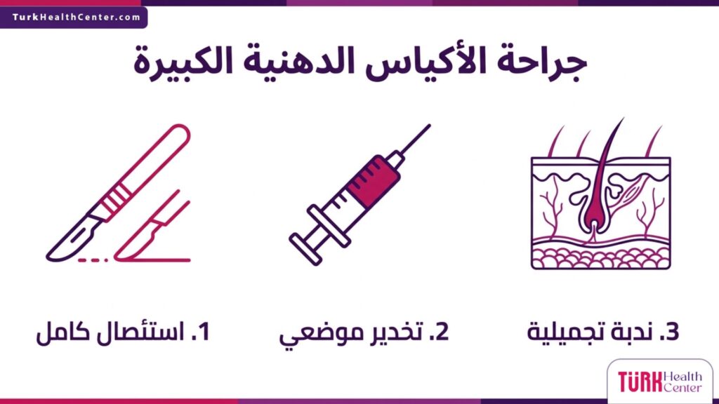 إنفوجرافيك يشرح 3 خطوات رئيسية لنجاح جراحة الأكياس الدهنية الكبيرة من الاستئصال وحتى التعافي.