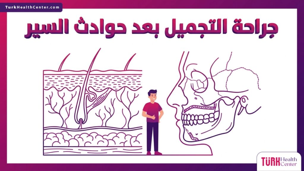 رسم إنفوجرافيك تشريحي دقيق يوضح عملية تجديد الأنسجة والعظام خلال جراحة التجميل بعد حوادث السير