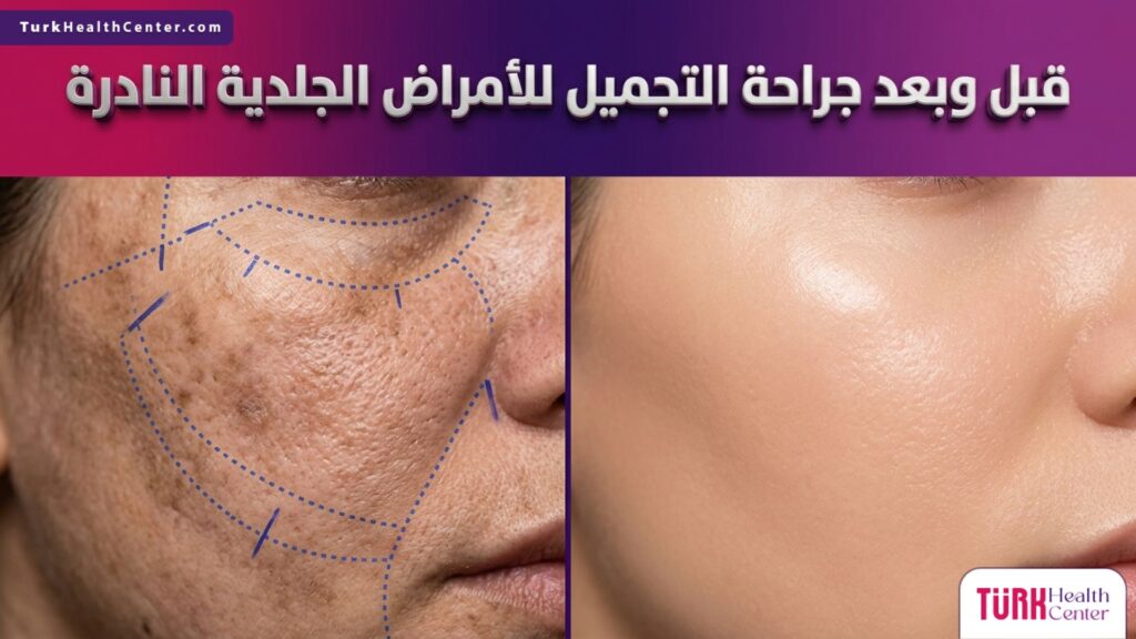 صورة مقسمة توضح النتائج المذهلة قبل وبعد جراحة التجميل للأمراض الجلدية النادرة مع علامات جراحية دقيقة
