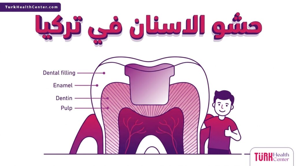 رسم بياني علمي يوضح التركيب التشريحي للسن وكيفية عمل حشو الاسنان في تركيا.
