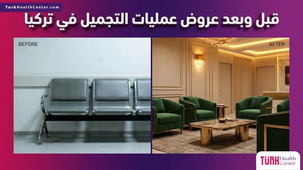 صورة مقسمة تظهر الفارق في الجودة والرفاهية قبل وبعد عروض عمليات التجميل في تركيا