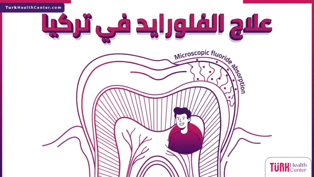 إنفوجرافيك علمي يوضح تشريح السن وامتصاص الفلورايد في علاج الفلورايد في تركيا