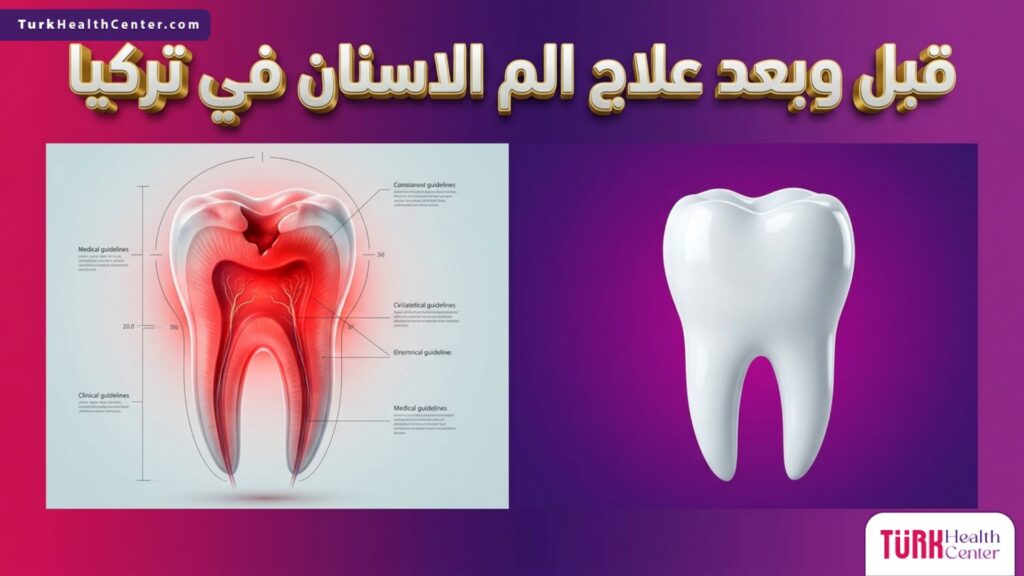 صورة قبل وبعد توضح النتائج المذهلة والفعالة لعملية علاج الم الاسنان في تركيا.