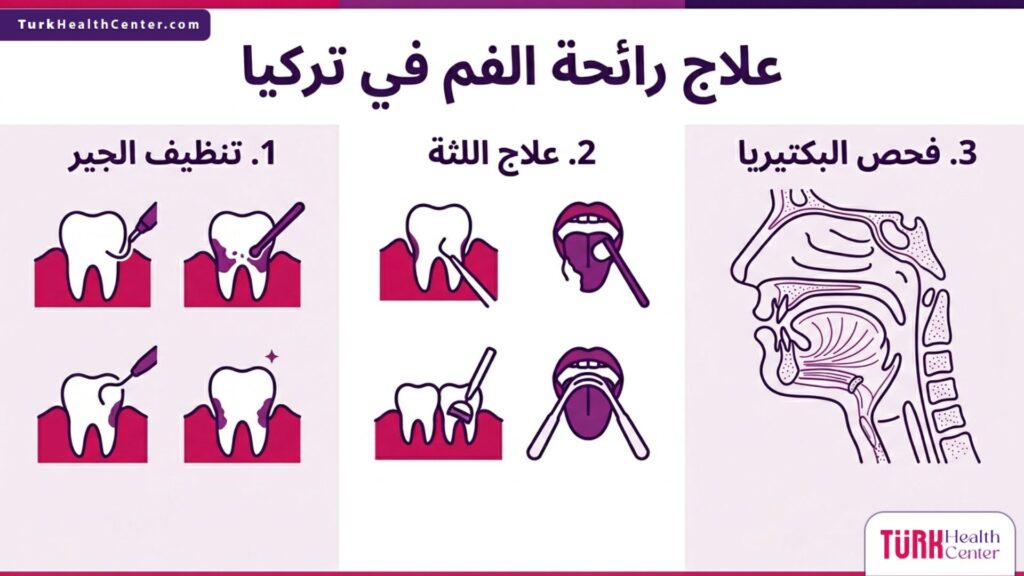 خطوات ومراحل الإجراءات الطبية المتبعة في علاج رائحة الفم في تركيا