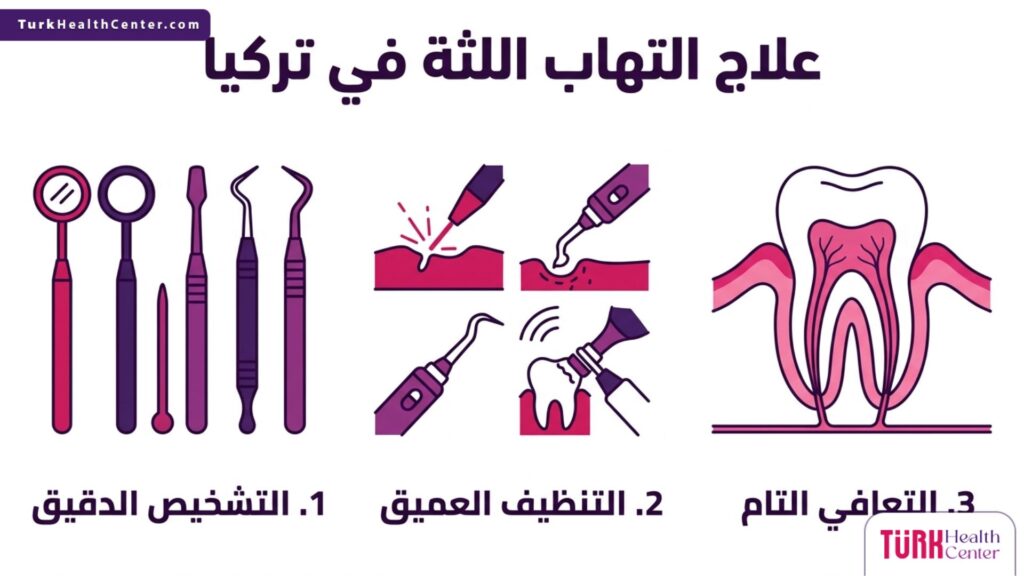 مخطط إنفوجرافيك يشرح الخطوات الثلاث الأساسية المتبعة في علاج نزيف اللثة في تركيا.