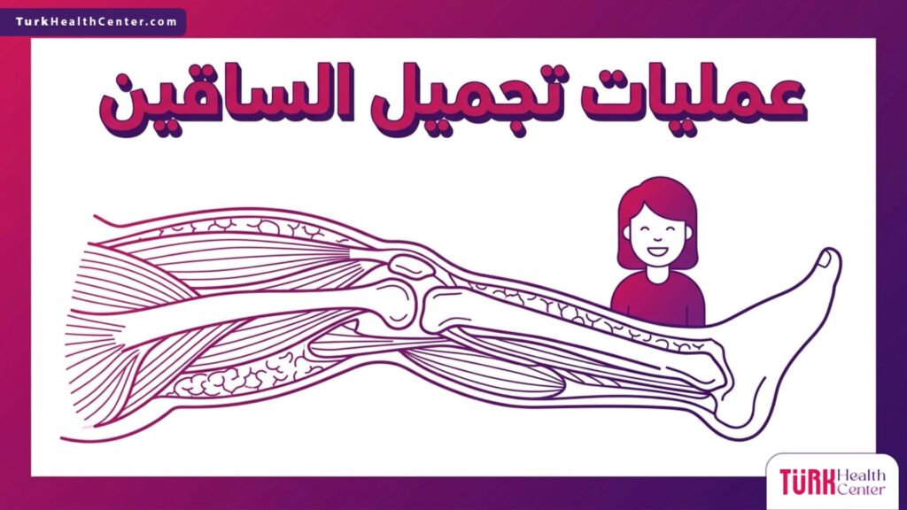 إنفوجرافيك طبي تشريحي يوضح البنية العضلية وتوزيع الدهون الخاص بإجراء عمليات تجميل الساقين.