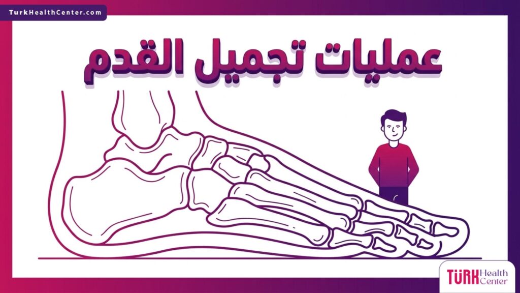 رسم تشريحي طبي متطور يوضح البنية العظمية الدقيقة وهيكل القدم في سياق عمليات تجميل القدم.