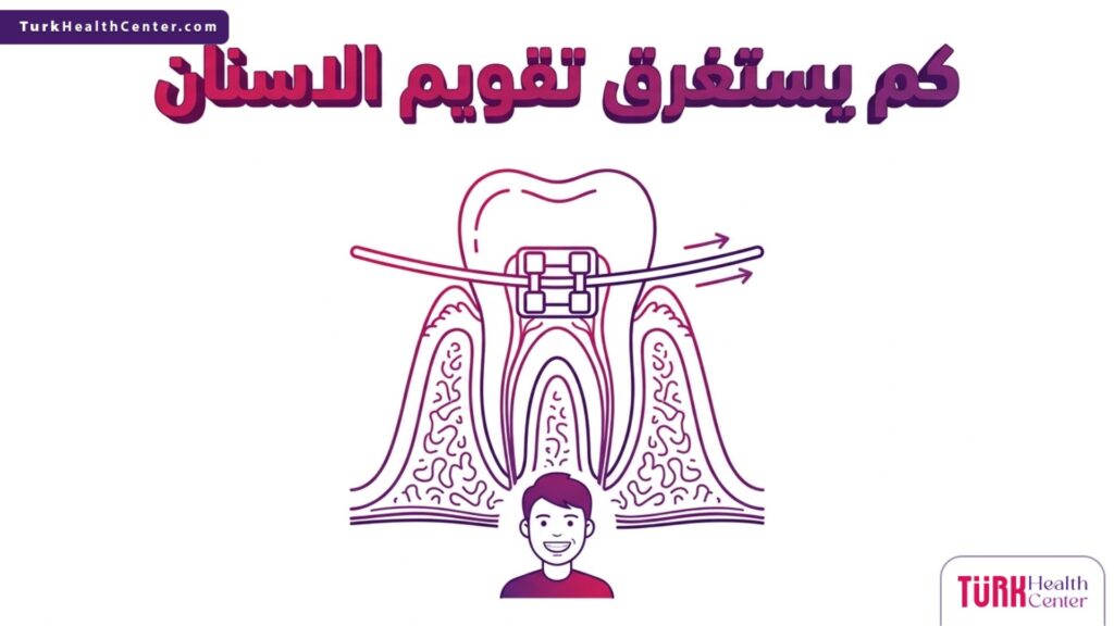 مخطط تشريحي طبي يشرح آلية عمل الأسنان وكم يستغرق تقويم الاسنان لتحقيق النتائج المطلوبة.