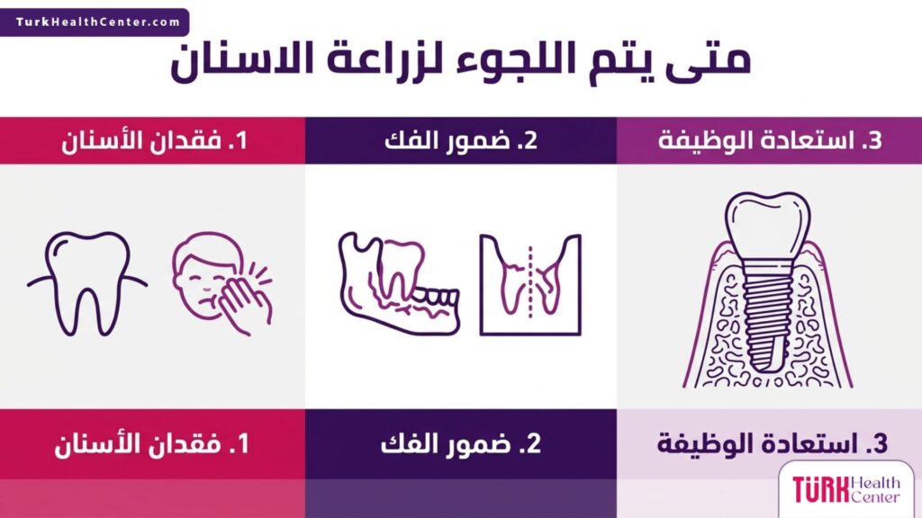 إنفوجرافيك يوضح الأسباب الرئيسية والدوافع حول متى يتم اللجوء لزراعة الاسنان بالتفصيل.