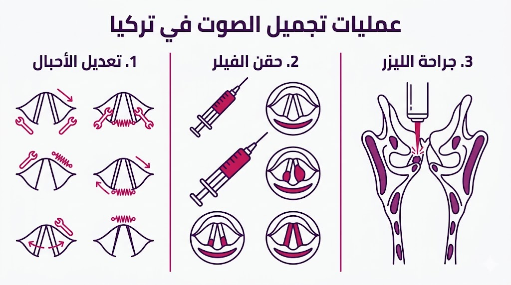  إنفوجرافيك تعليمي يوضح التقنيات الثلاث الرئيسية المستخدمة في عمليات تجميل الصوت في تركيا.