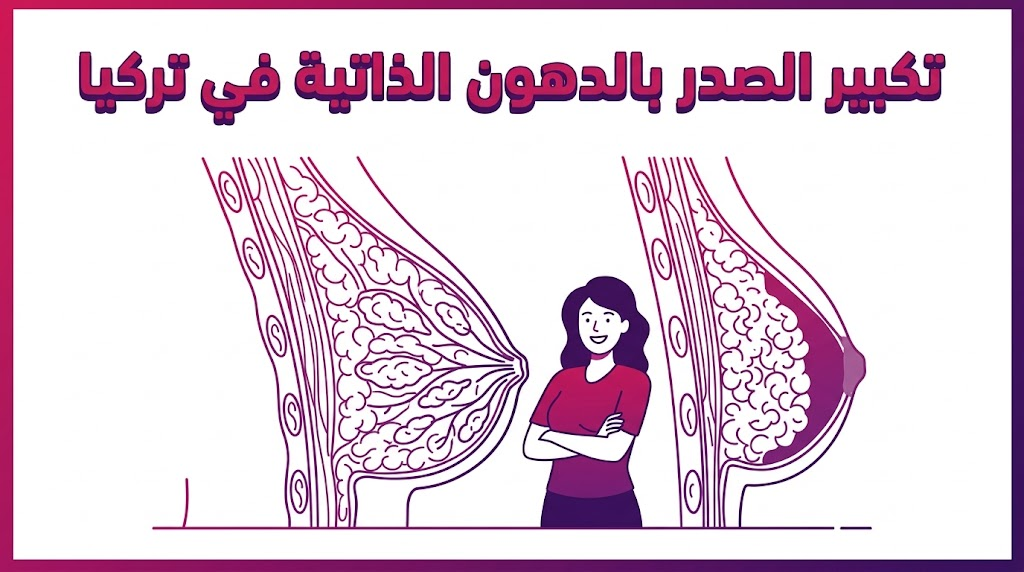 مخطط تشريحي طبي بالرسم المتجهي يوضح توزيع الخلايا لعملية تكبير الصدر بالدهون الذاتية في تركيا بشكل علمي دقيق.