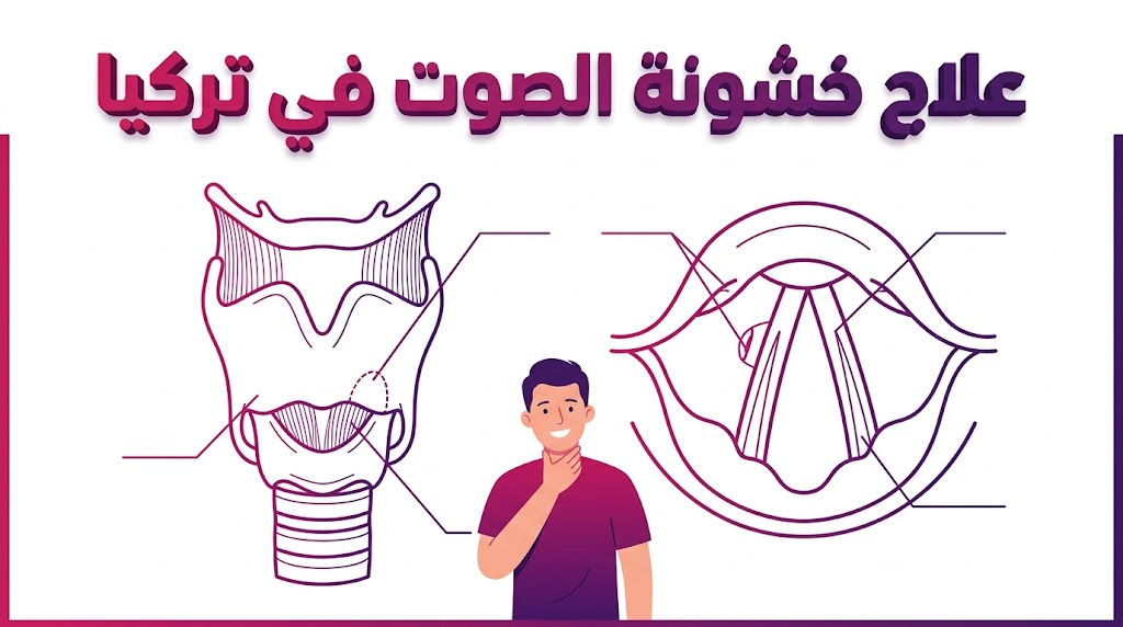 مخطط تشريحي يوضح الآلية الطبية الدقيقة المتبعة في علاج خشونة الصوت في تركيا.