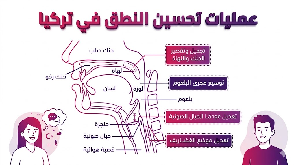 مخطط طبي تعليمي يوضح التفاصيل التشريحية الدقيقة لخطوات عمليات تحسين النطق في تركيا بأسلوب فني راقٍ.