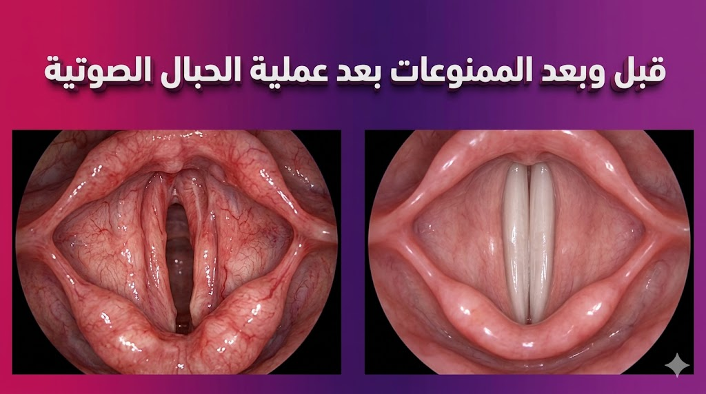  مقارنة قبل وبعد تظهر تحسن الحنجرة عند الالتزام بقائمة الممنوعات بعد عملية الحبال الصوتية.