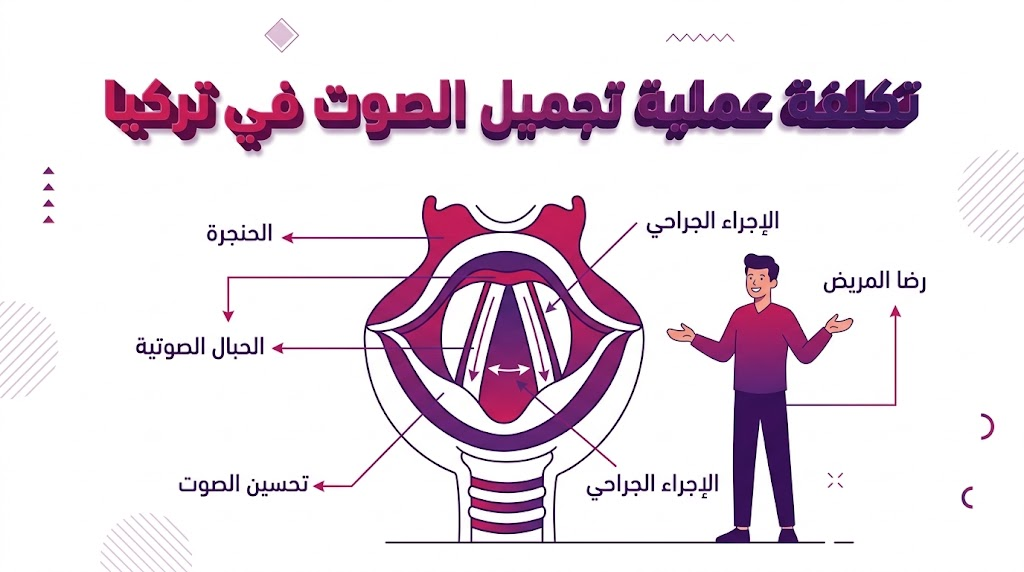 مخطط تشريحي تفصيلي يوضح الحبال الصوتية وآلية الجراحة المتعلقة بـ تكلفة عملية تجميل الصوت في تركيا.