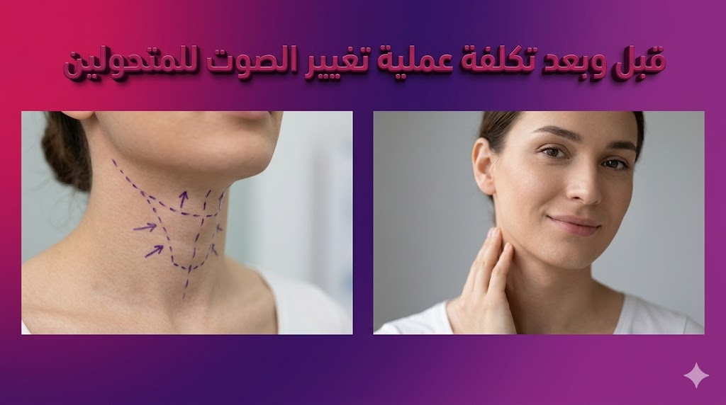 مقارنة قبل وبعد توضح نتائج و تكلفة عملية تغيير الصوت للمتحولين مع علامات جراحية دقيقة.