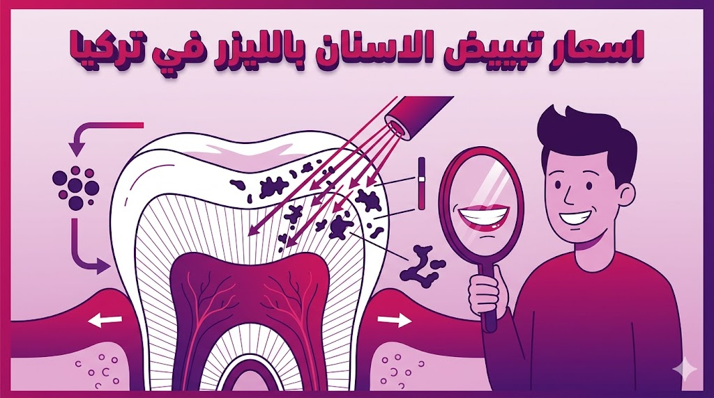  مخطط تشريحي يوضح آلية عمل الليزر وتأثيره على اسعار تبييض الاسنان بالليزر في تركيا.